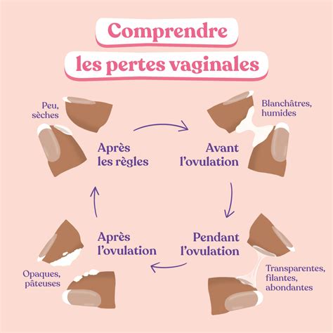 perte blanche infection|Pertes blanches : causes, prévention et traitement